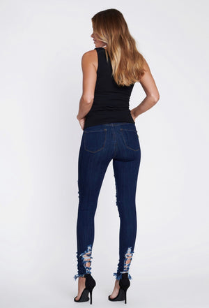 Desperately Distressed Dark Stone Skinny Jeans